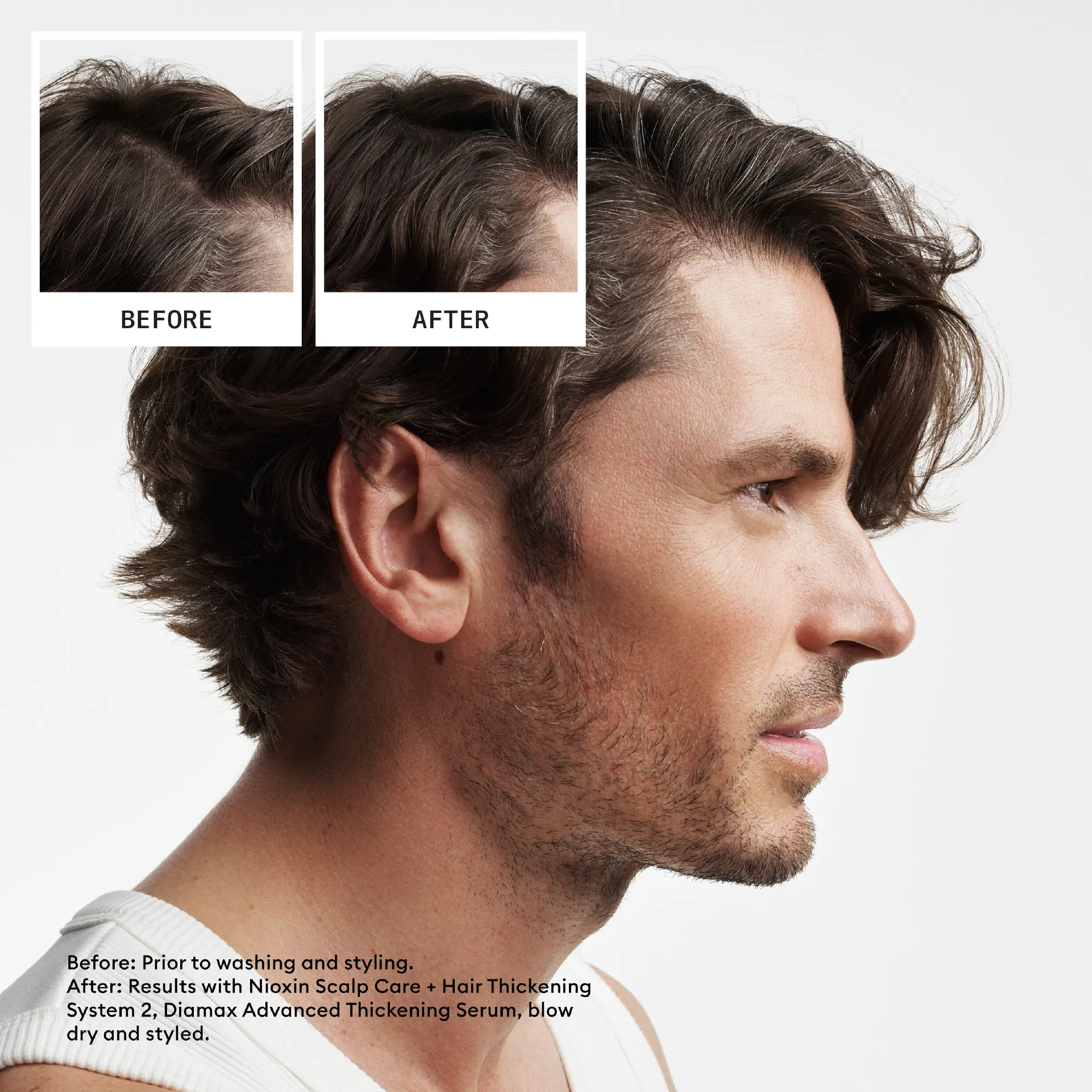 Nioxin System 2 Scalp   Hair Thickening Conditioner for Natural Hair with Progressed Thinning 300ml